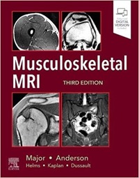 copertina di Musculoskeletal MRI ( Magnetic Resonance Imaging )