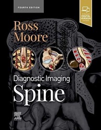 copertina di Diagnostic Imaging - Spine