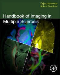 copertina di Handbook of Imaging in Multiple Sclerosis