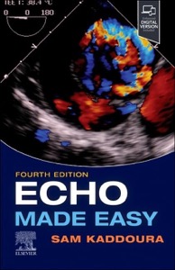 copertina di Echo Made Easy