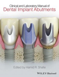 copertina di Clinical and Laboratory Manual of Dental Implant Abutments