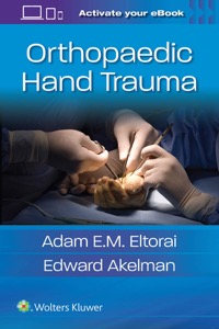 copertina di Orthopaedic Hand Trauma