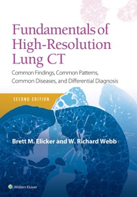copertina di Fundamentals of High - Resolution Lung CT : Common Findings , Common Patterns , Common ...