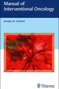 copertina di Manual of Interventional Oncology