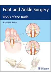 copertina di Foot and Ankle Surgery - Tricks of the Trade