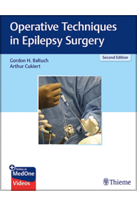 copertina di Operative Techniques in Epilepsy Surgery