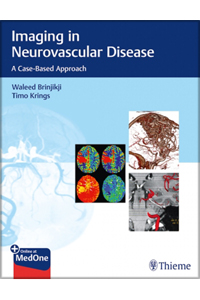 copertina di Imaging in Neurovascular Disease - A Case - Based Approach
