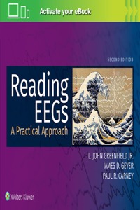 copertina di Reading EEGs ( Electroencephalography ) :  A Practical Approach