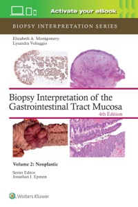 copertina di Biopsy Interpretation of the Gastrointestinal Tract Mucosa. Neoplastic