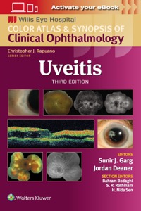 copertina di Uveitis - Color atlas and synopsis of clinical ophtalmology