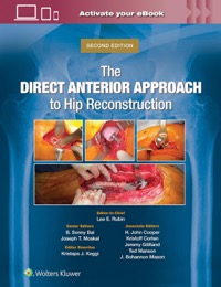copertina di The Direct Anterior Approach to Hip Reconstruction