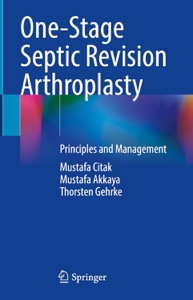 copertina di One - Stage Septic Revision Arthroplasty. Principles and Management