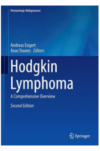 copertina di Hodgkin Lymphoma - A Comprehensive Overview