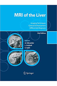 copertina di MRI ( Magnetic Resonance Imaging ) of the Liver - Imaging Techniques, Contrast Enhancement, ...