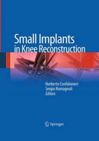 copertina di Small Implants in Knee Reconstruction