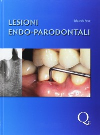 copertina di Lesioni endo - parodontali